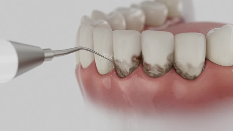 Reliable Dental contractor in Spooner, WI by Smile Center Dentistry